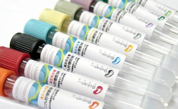 12月8号，，，，，，，，旋乐吧spin8被评为2011年度上海市优异手艺带动人