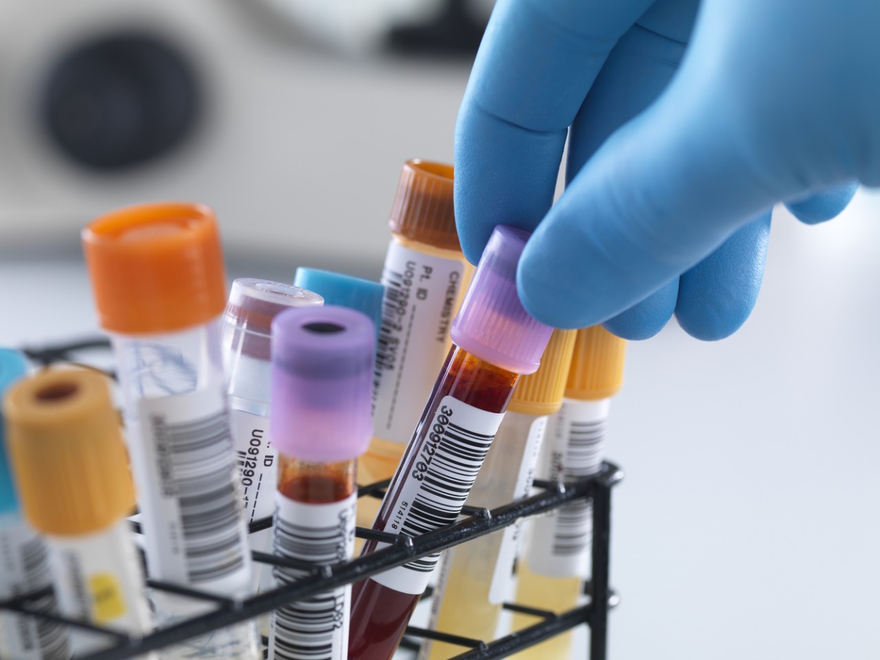 一致性评价大幕开启，，，，医院市场即将调解