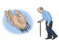 帕金森病，，，，，，，，“帕”不怕？？？？