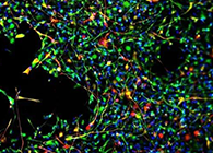 天下首创：药物将干细胞指导至受损部位，，，，提高其愈合能力！
