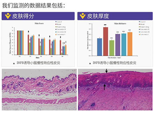 旋乐吧spin8建设的特应性皮炎及湿疹模子监测数据效果