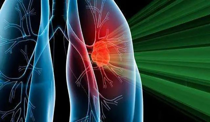 盛世泰科1类立异药物CGT-9475实现中美双报双批 | 旋乐吧spin8一站式临床宿世物医药研发效劳平台助力